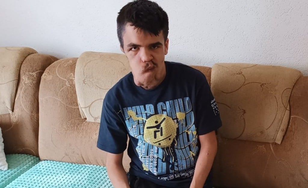 Amelu je tumor deformisao lice, pomozimo mu