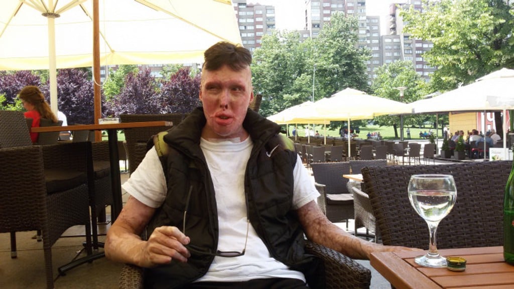 Aldinu je jedina želja da ima normalan život